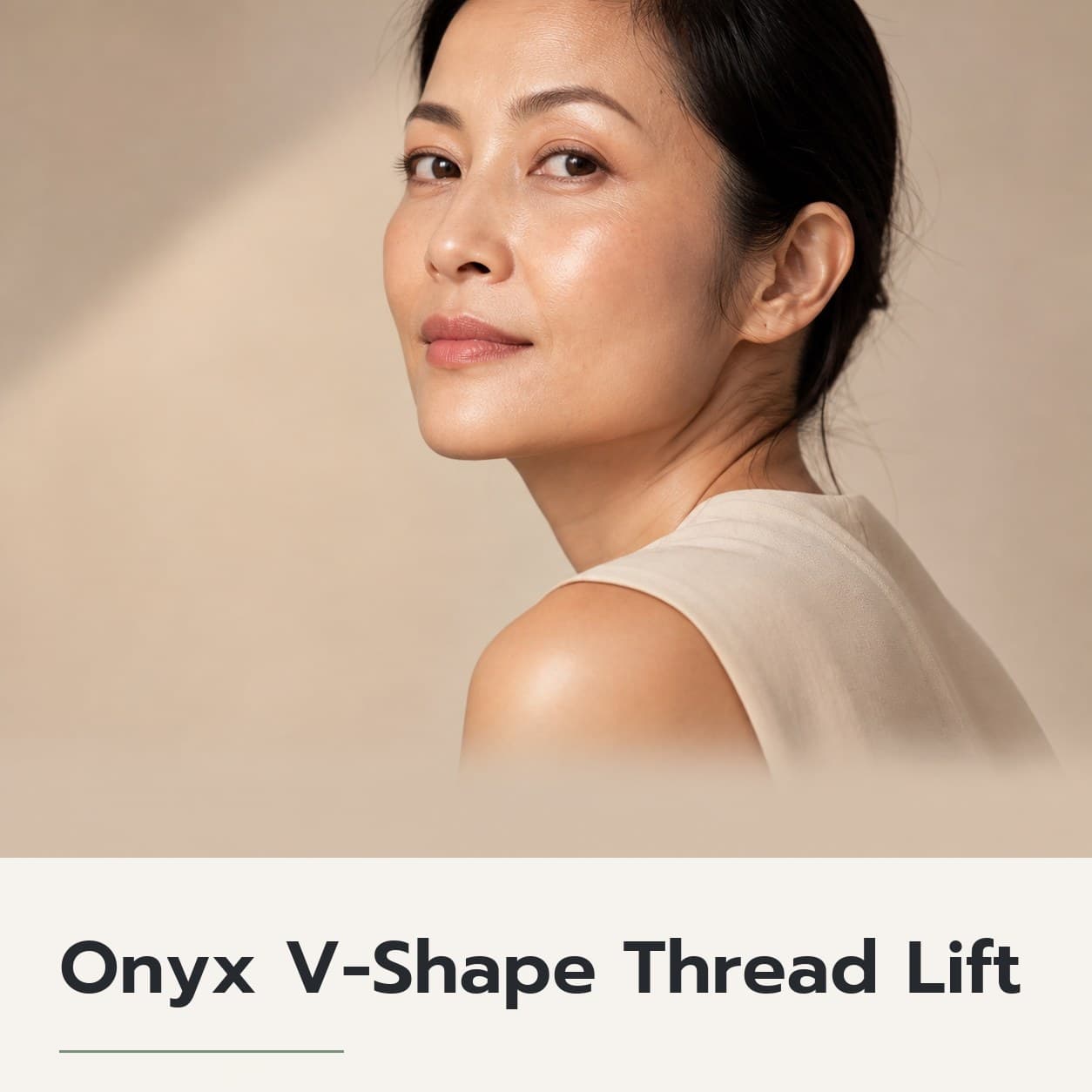 Onyx V-Shape Thread Lift