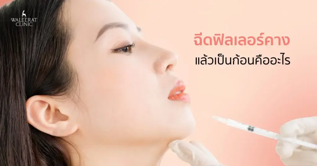 aesthetic treatment at Waleerat Clinic Bangkok — Waleerat APR