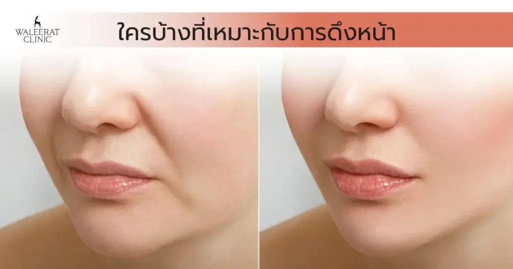 aesthetic treatment at Waleerat Clinic Bangkok — Waleerat Feb2