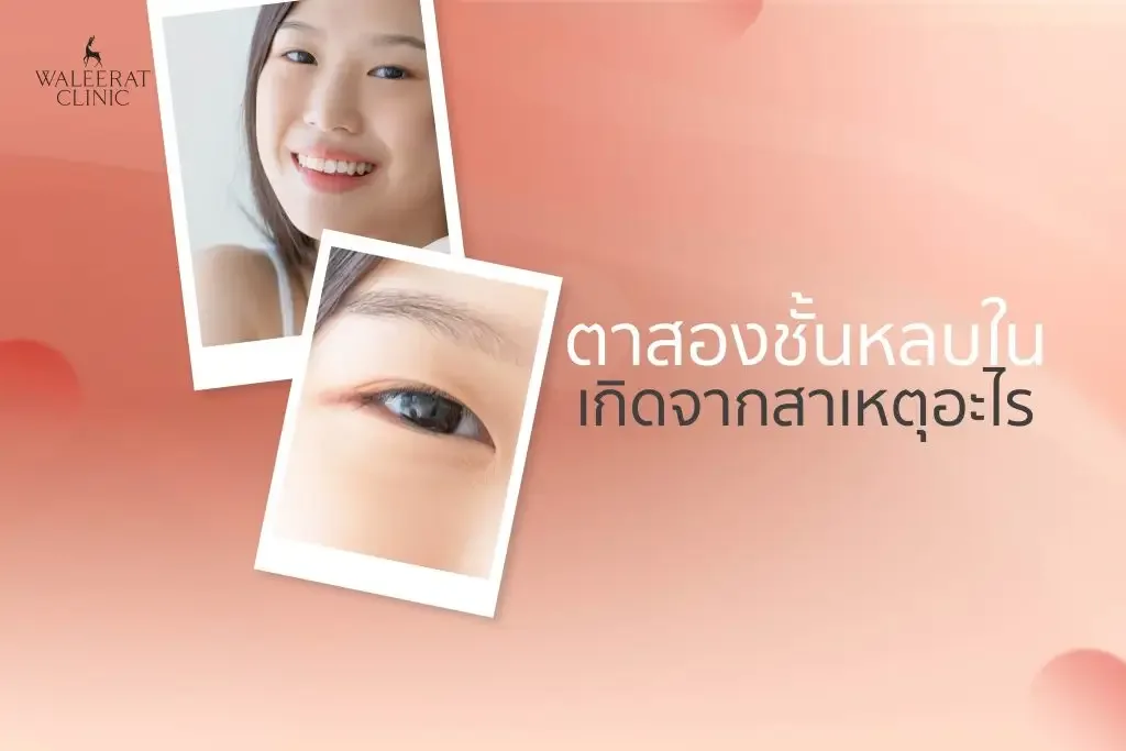 aesthetic treatment at Waleerat Clinic Bangkok — Apr5