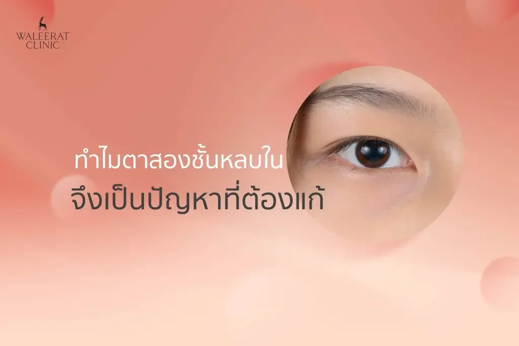 aesthetic treatment at Waleerat Clinic Bangkok — Apr5