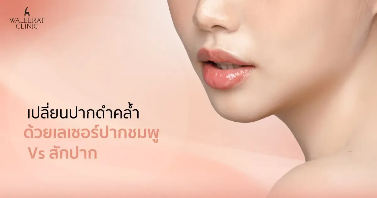 เลเซอร์ปากชมพูด้วย Pico-Laser แก้ปัญหาปากคล้ำจากเม็ดสี